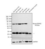 EPHX2 Antibody in Western Blot (WB)