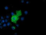 Adenylate Kinase 5 Antibody in Immunocytochemistry (ICC/IF)