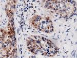 Adenylate Kinase 5 Antibody in Immunohistochemistry (Paraffin) (IHC (P))