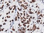 Adenylate Kinase 5 Antibody in Immunohistochemistry (Paraffin) (IHC (P))