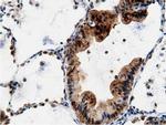 Adenylate Kinase 5 Antibody in Immunohistochemistry (Paraffin) (IHC (P))