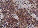 PRKD2 Antibody in Immunohistochemistry (Paraffin) (IHC (P))