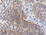 PRKD2 Antibody in Immunohistochemistry (Paraffin) (IHC (P))