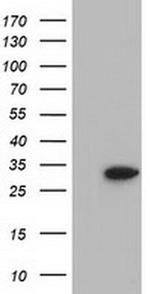 SULT2A1 Antibody in Western Blot (WB)