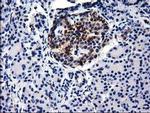 GGPS1 Antibody in Immunohistochemistry (Paraffin) (IHC (P))