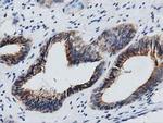 GAS7 Antibody in Immunohistochemistry (Paraffin) (IHC (P))