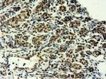 EPM2AIP1 Antibody in Immunohistochemistry (Paraffin) (IHC (P))