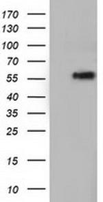 TCP11L2 Antibody in Western Blot (WB)