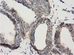 Adenylate Kinase 3 Antibody in Immunohistochemistry (Paraffin) (IHC (P))