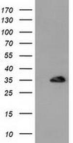 SULT1A1 Antibody in Western Blot (WB)