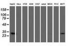 SULT1A1 Antibody in Western Blot (WB)