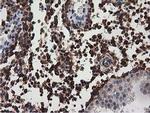 MICAL1 Antibody in Immunohistochemistry (Paraffin) (IHC (P))