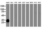 SULT1A1 Antibody in Western Blot (WB)