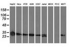 SPR Antibody in Western Blot (WB)