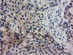 RASD2 Antibody in Immunohistochemistry (Paraffin) (IHC (P))