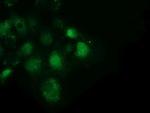 SPR Antibody in Immunocytochemistry (ICC/IF)