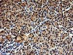 SAMHD1 Antibody in Immunohistochemistry (Paraffin) (IHC (P))