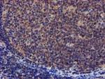 PYCRL Antibody in Immunohistochemistry (Paraffin) (IHC (P))