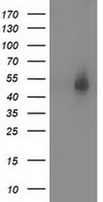 Syntrophin alpha-1 Antibody in Western Blot (WB)