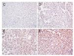 Annexin A3 Antibody in Immunohistochemistry (Paraffin) (IHC (P))