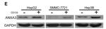 Annexin A3 Antibody in Western Blot (WB)