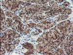 DUPD1 Antibody in Immunohistochemistry (Paraffin) (IHC (P))