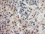 GRHPR Antibody in Immunohistochemistry (Paraffin) (IHC (P))