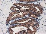 Annexin A3 Antibody in Immunohistochemistry (Paraffin) (IHC (P))