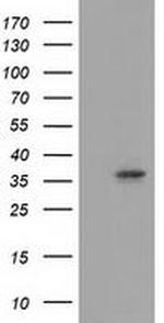 Annexin A3 Antibody in Western Blot (WB)