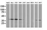 Annexin A3 Antibody in Western Blot (WB)