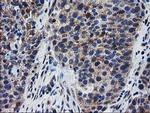 BIN3 Antibody in Immunohistochemistry (Paraffin) (IHC (P))