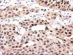 GALE Antibody in Immunohistochemistry (Paraffin) (IHC (P))