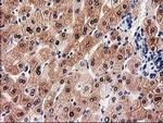 GALE Antibody in Immunohistochemistry (Paraffin) (IHC (P))