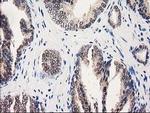 GALE Antibody in Immunohistochemistry (Paraffin) (IHC (P))