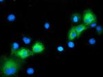 ERK5 Antibody in Immunocytochemistry (ICC/IF)