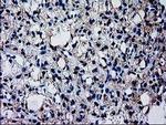 GCKR Antibody in Immunohistochemistry (Paraffin) (IHC (P))