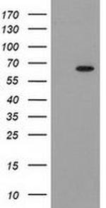 GCKR Antibody in Western Blot (WB)