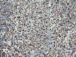 SAMHD1 Antibody in Immunohistochemistry (Paraffin) (IHC (P))