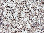 SAMHD1 Antibody in Immunohistochemistry (Paraffin) (IHC (P))