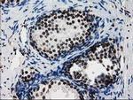 FKBPL Antibody in Immunohistochemistry (Paraffin) (IHC (P))