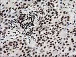 FKBPL Antibody in Immunohistochemistry (Paraffin) (IHC (P))