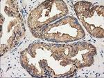 HDAC6 Antibody in Immunohistochemistry (Paraffin) (IHC (P))