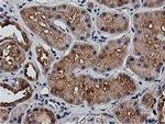 HDAC6 Antibody in Immunohistochemistry (Paraffin) (IHC (P))