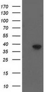 HSP40 Antibody in Western Blot (WB)