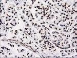 ATP6V1F Antibody in Immunohistochemistry (Paraffin) (IHC (P))