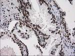 ATP6V1F Antibody in Immunohistochemistry (Paraffin) (IHC (P))