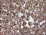 ACY3 Antibody in Immunohistochemistry (Paraffin) (IHC (P))