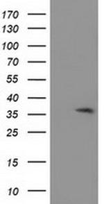 ACY3 Antibody in Western Blot (WB)