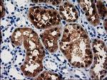 ACY3 Antibody in Immunohistochemistry (Paraffin) (IHC (P))