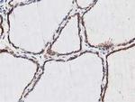 NUDT6 Antibody in Immunohistochemistry (Paraffin) (IHC (P))